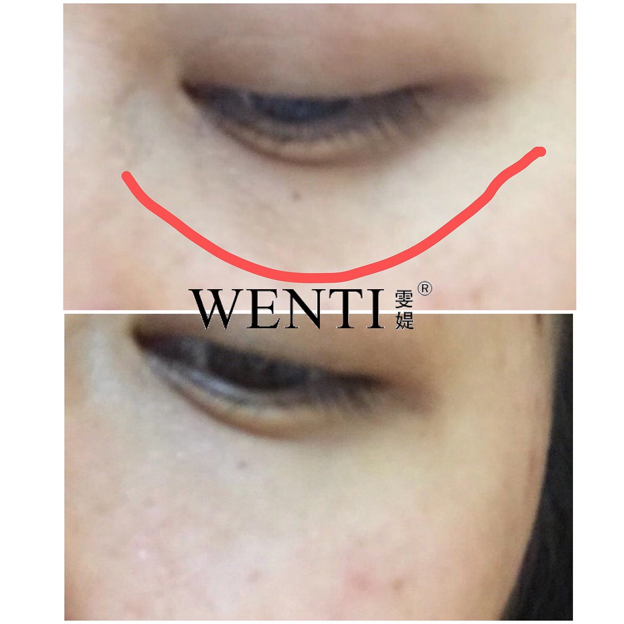 一颗向上的心|不该有下坠的皱纹|雯媞魔贴实拍修图魔贴