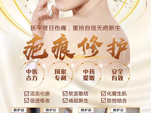 疤痕 妊娠紋 痘坑痘印修護(hù) 美業(yè)（個(gè)人主頁(yè)-ZNDcwOTgxMzI=） - 海報(bào) - 站酷設(shè)計(jì)師愛(ài)跳的木頭人原創(chuàng)素材 - 站酷ZCOOL