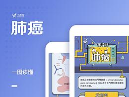 信息可视化设计案例