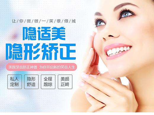 隐适美牙齿矫正