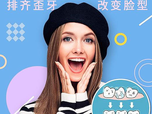 隐适美牙齿美学矫正详情