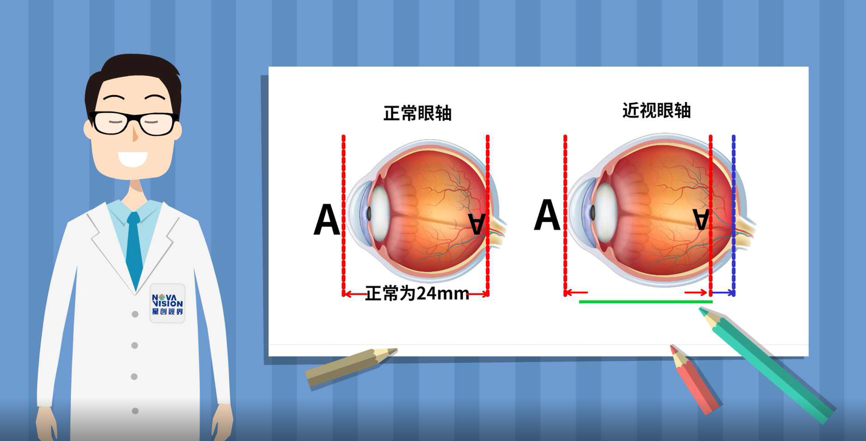 众视好视力保护|平面|Logo|黄DD - 原创作品 - 站酷 (ZCOOL)
