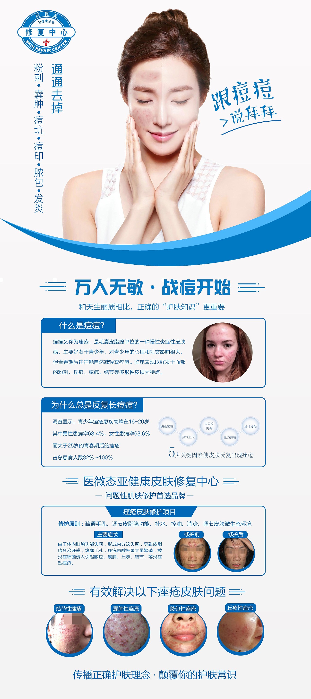 美容祛痘护肤展架