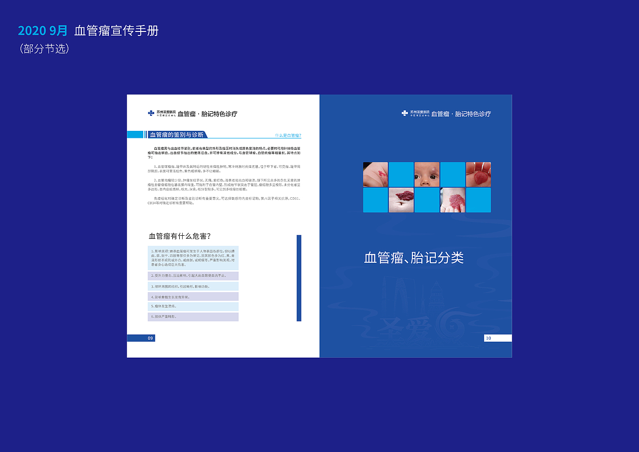 2020|9月 血管瘤宣传手册