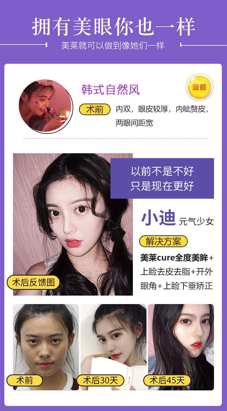 详情页活动版块