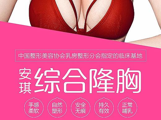 综合隆胸——整形美容医疗活动专题