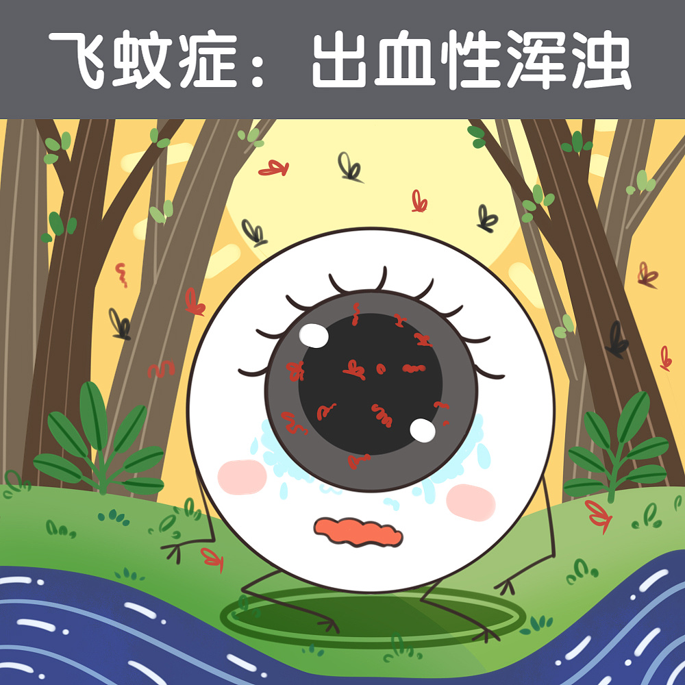 飞蚊症