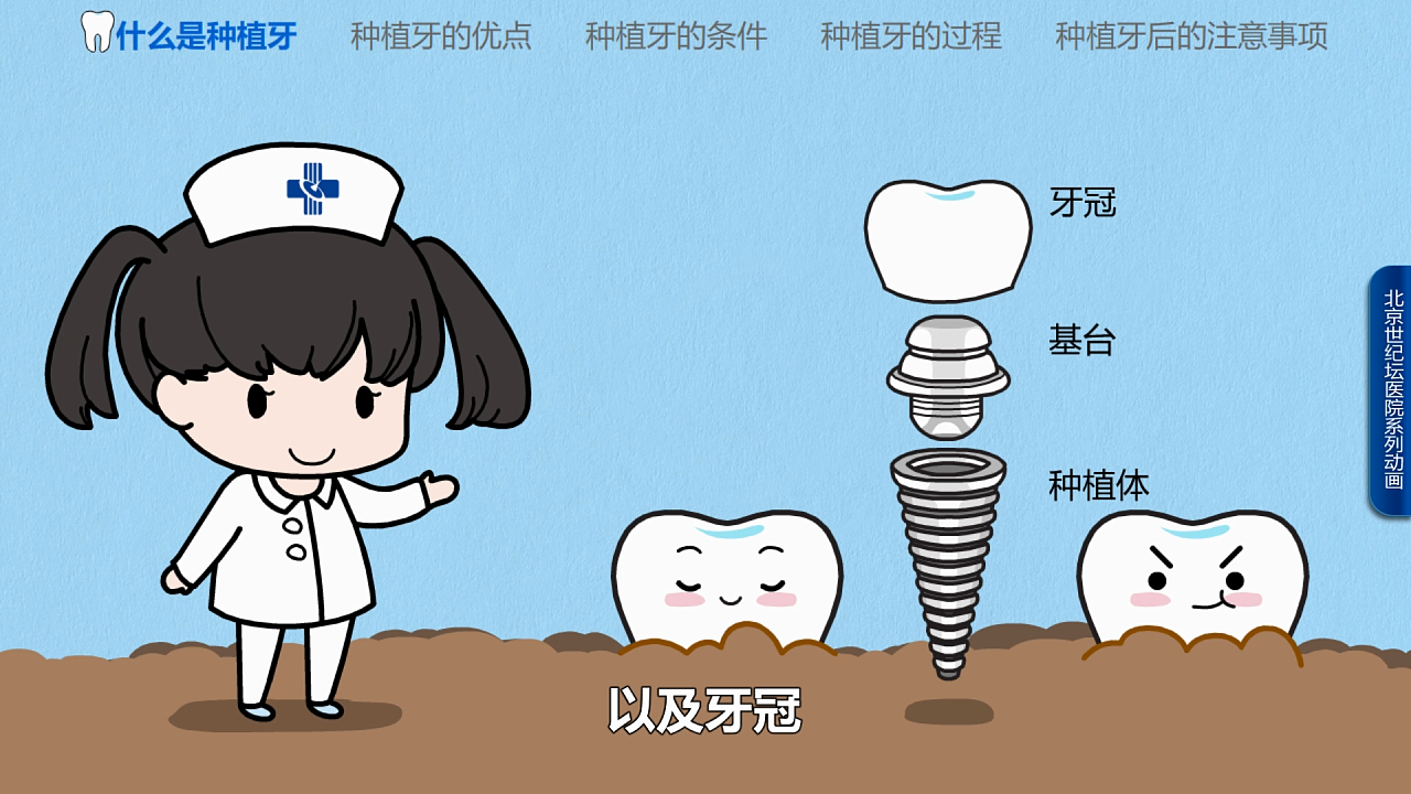 医院科普系列动画-种植牙