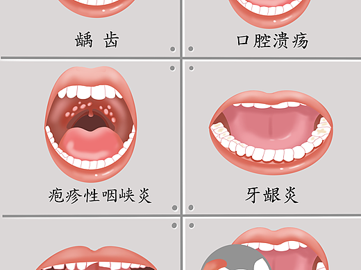 医学插画习作