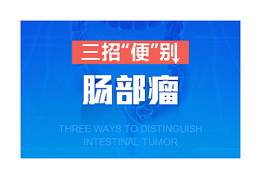 WUI—广告图（图ZODk0ODUxNDA=） - 其他网页 - 站酷设计师ceci0627原创素材 - 站酷ZCOOL