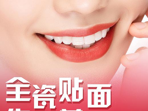 全瓷贴面宣传系列海报