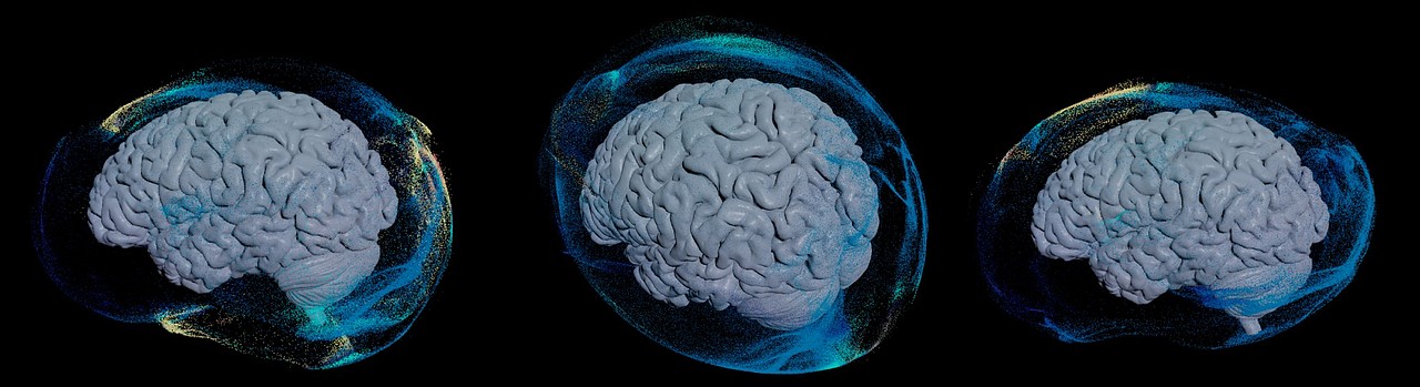 脑新生 动态设计（图ZMzE1MTE0MDIw） - 人物/生物 - 站酷设计师omoolab原创素材 - 站酷ZCOOL