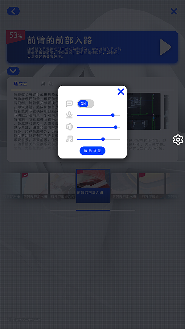 手術(shù)入路項目（圖ZMjMwNjE3MTQw） - 軟件界面 - 站酷設(shè)計師ivy129123原創(chuàng)素材 - 站酷ZCOOL