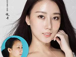 貴陽華美美杜莎逆齡美眼，變大你的雙眼