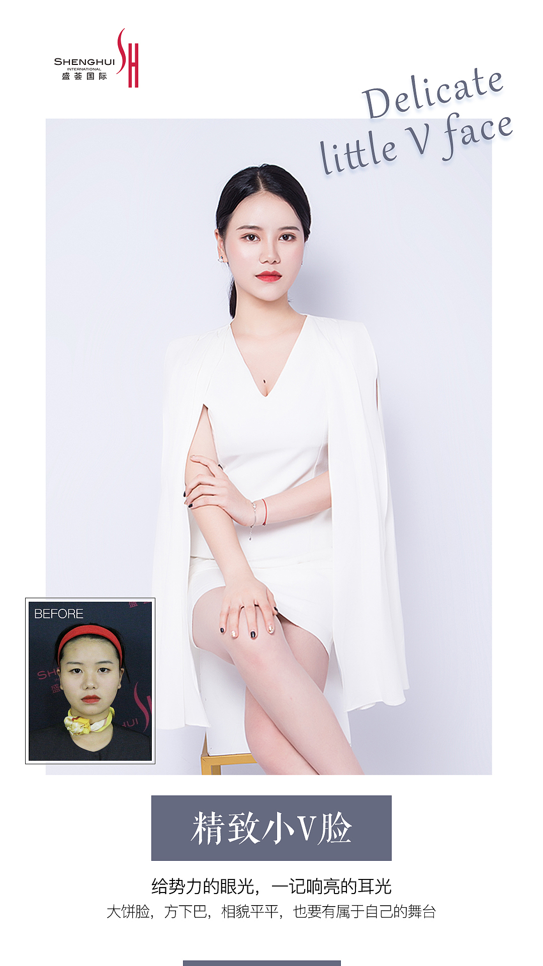 案例对比（图ZMjEzNzAwMTAw） - 宣传物料 - 站酷设计师爱上设计的一只猫原创素材 - 站酷ZCOOL