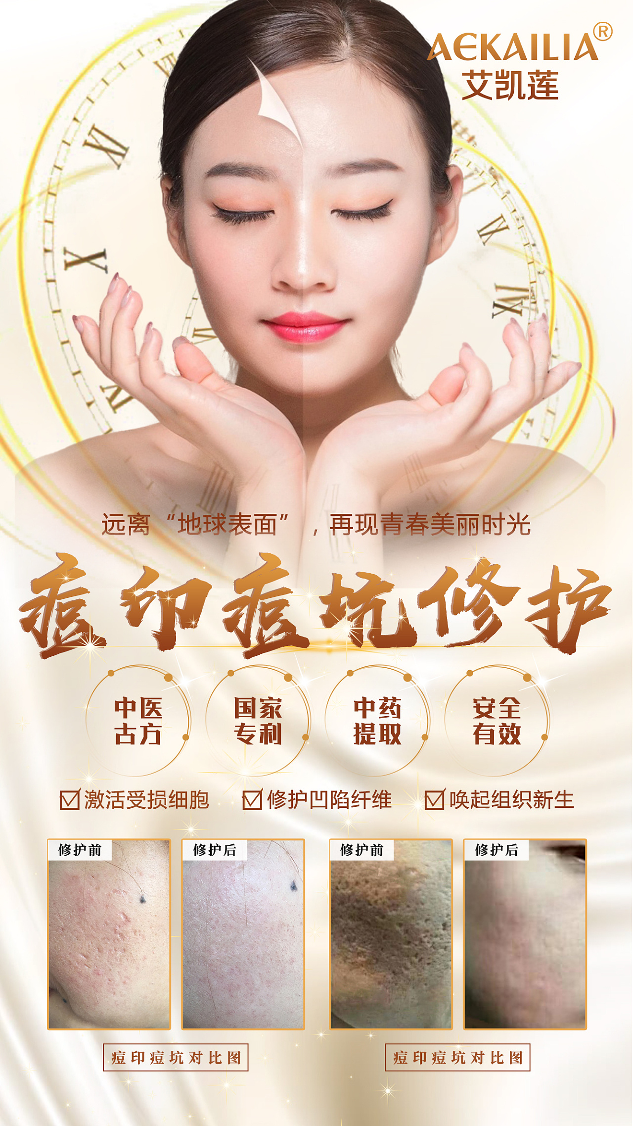 疤痕 妊娠纹 痘坑痘印修护 美业|平面|海报|爱跳的