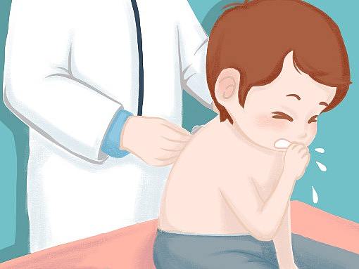 医文--儿童慢性咳嗽