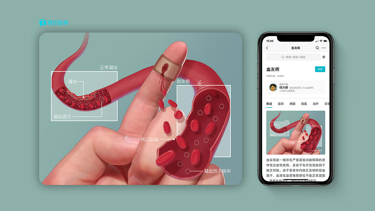 2020腾讯医典医学插画作品集（图ZMjM2OTEyNzE2） - 艺术插画 - 站酷设计师不当咸鱼的咸鱼原创素材 - 站酷ZCOOL