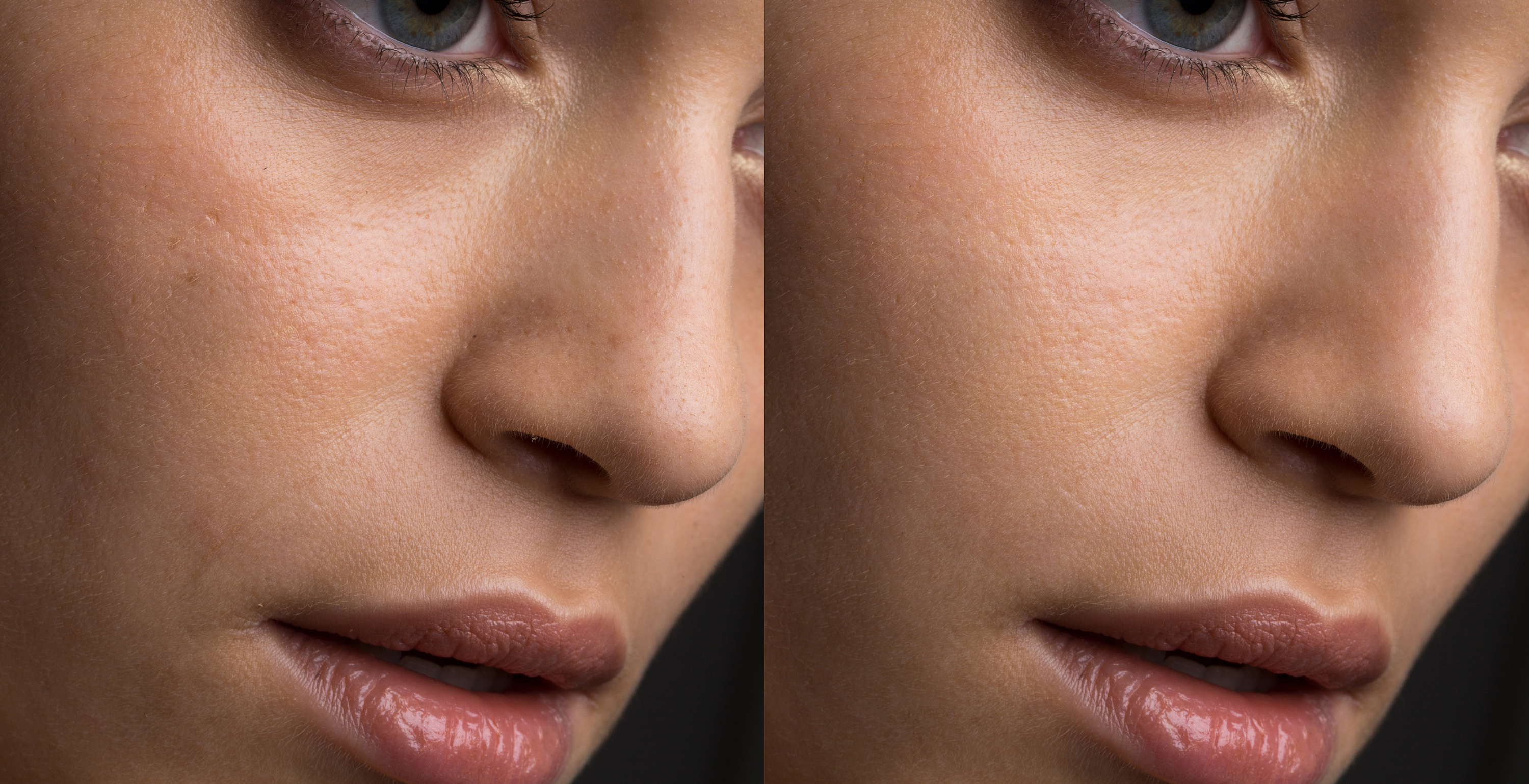 每日一更-双曲线磨皮