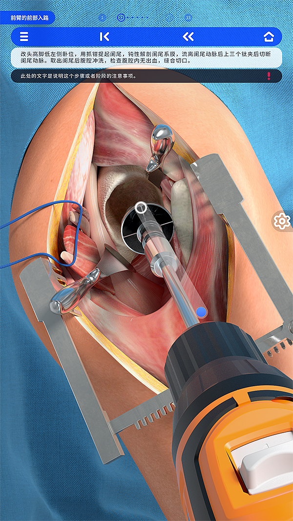 手術(shù)入路項目（圖ZMjMwNjE3MTU2） - 軟件界面 - 站酷設(shè)計師ivy129123原創(chuàng)素材 - 站酷ZCOOL