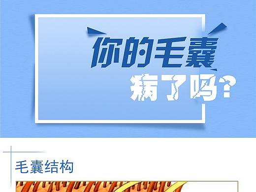 丝缘植发毛囊检护专题