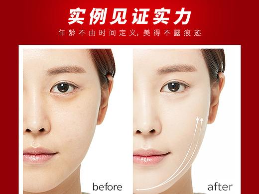 美容整形热玛吉宣传图