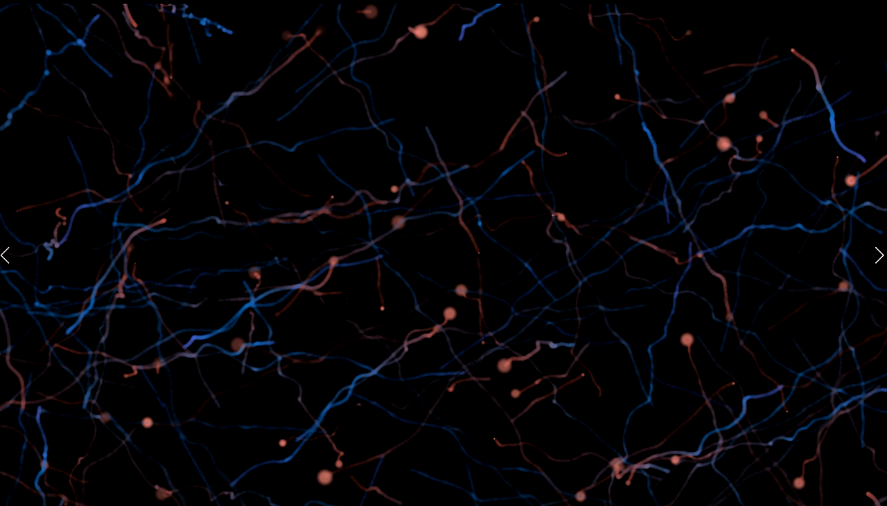 BRAIN 神經(jīng)元發(fā)散效果（圖ZMTQ5NjQ5NzYw） - 影視后期 - 站酷設計師認真真原創(chuàng)素材 - 站酷ZCOOL