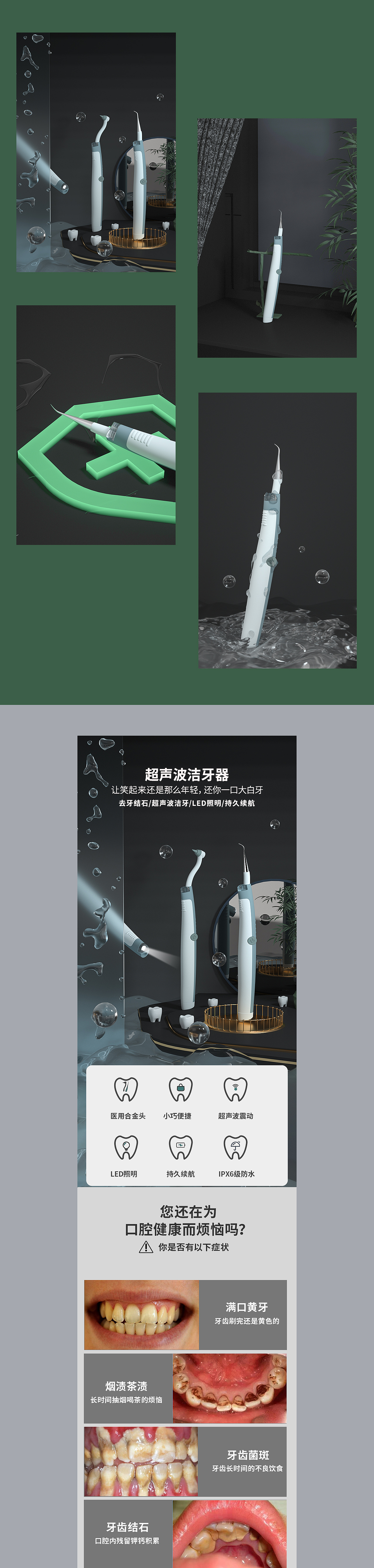 超声波洗牙器