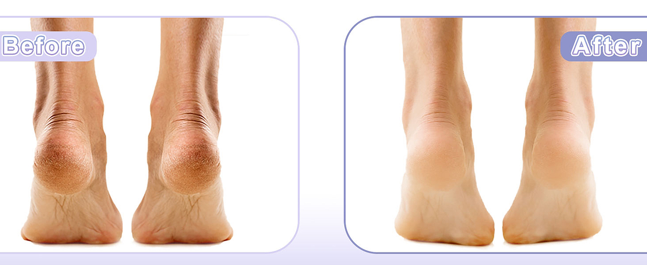 电商视觉设计｜跨境电商（图ZMzMzOTE1NTQ0） - 电商 - 站酷设计师西贝冰冰原创素材 - 站酷ZCOOL