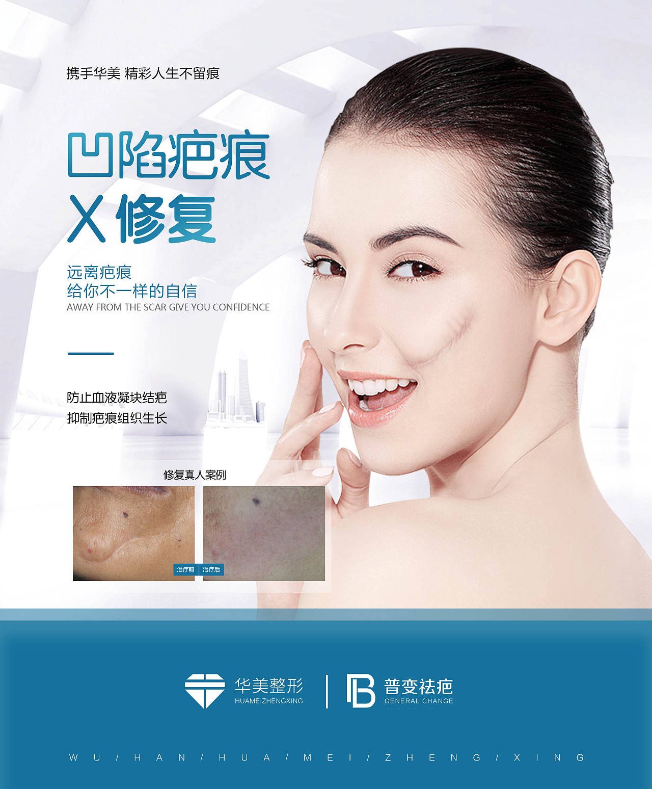 医疗皮肤科疤痕海报