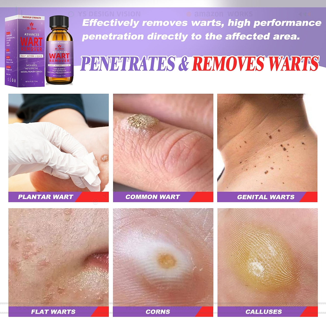 亚马逊祛疣精华液主图A+详情设计