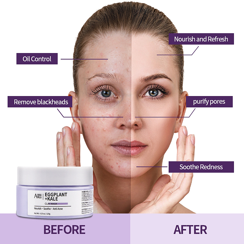 茄子泥膜（图ZMjY5OTE3NzQw） - 电商 - 站酷设计师MY乖乖原创素材 - 站酷ZCOOL