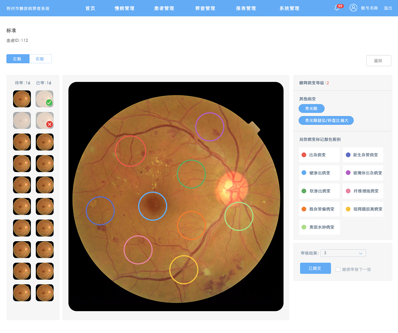 医疗眼底镜部分