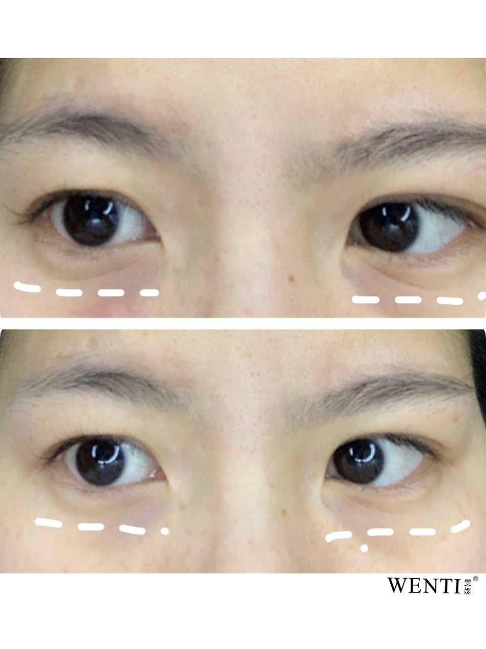 一颗向上的心|不该有下坠的皱纹|雯媞魔贴实拍修图魔贴