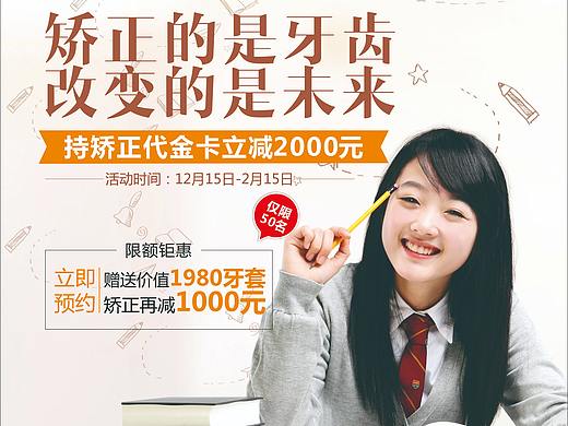 牙齿矫正-牙齿种植