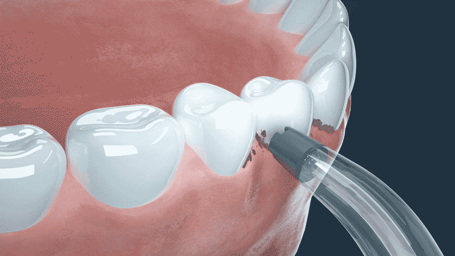 冲牙器详情（图ZMjgwMDQ3NDYw） - 电商 - 站酷设计师青博原创素材 - 站酷ZCOOL