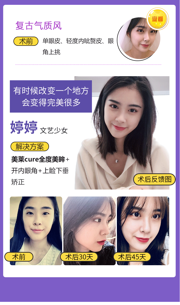 详情页活动版块