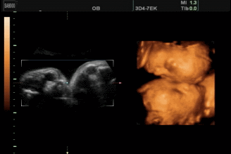 微信图-GIF设计（图ZODA1OTkzODg=） - 品牌 - 站酷设计师大呀嘛大太阳原创素材 - 站酷ZCOOL