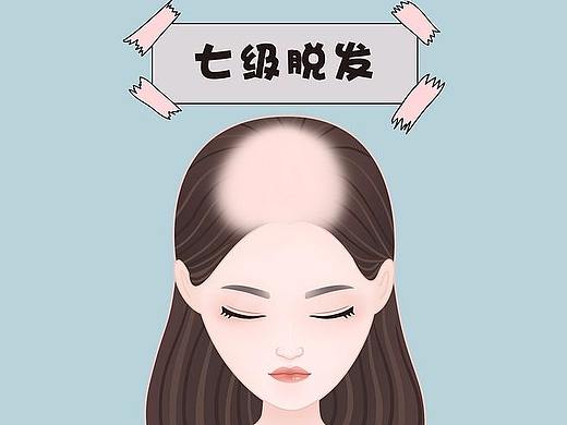 脱发、头部
