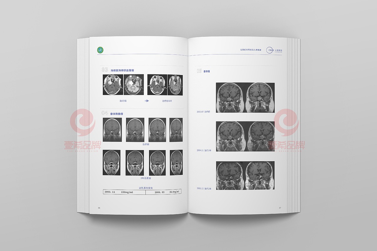 一希品牌设计--医疗设备公司画册宣传册设计（图ZMjI4NDY3NDky） - 书籍/画册 - 站酷设计师一希品牌设计原创素材 - 站酷ZCOOL