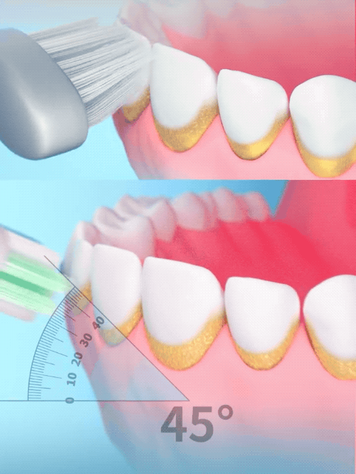 平面&视频|unsmile y4电动牙刷