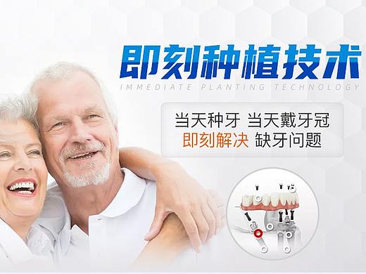 口腔医疗-牙齿种植专题页-种植牙落地页