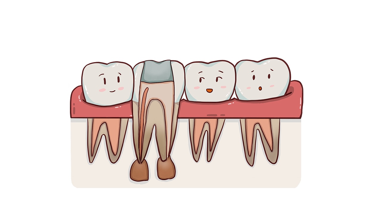 根管治療流程（圖ZMTgyNzE0MDE2） - 創(chuàng)作習(xí)作 - 站酷設(shè)計(jì)師劉玉美口腔插畫原創(chuàng)素材 - 站酷ZCOOL