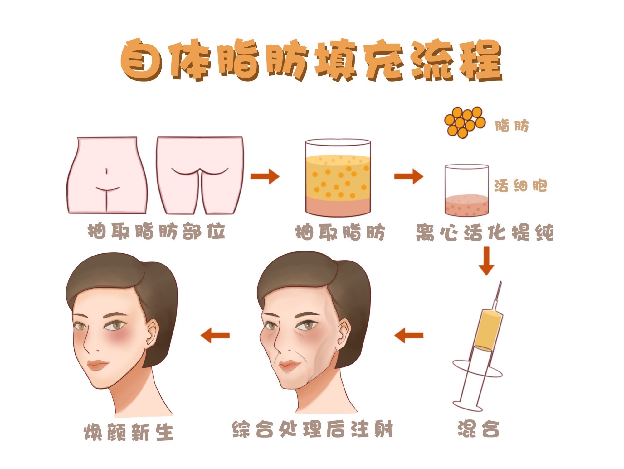 脂肪填充面部凹陷