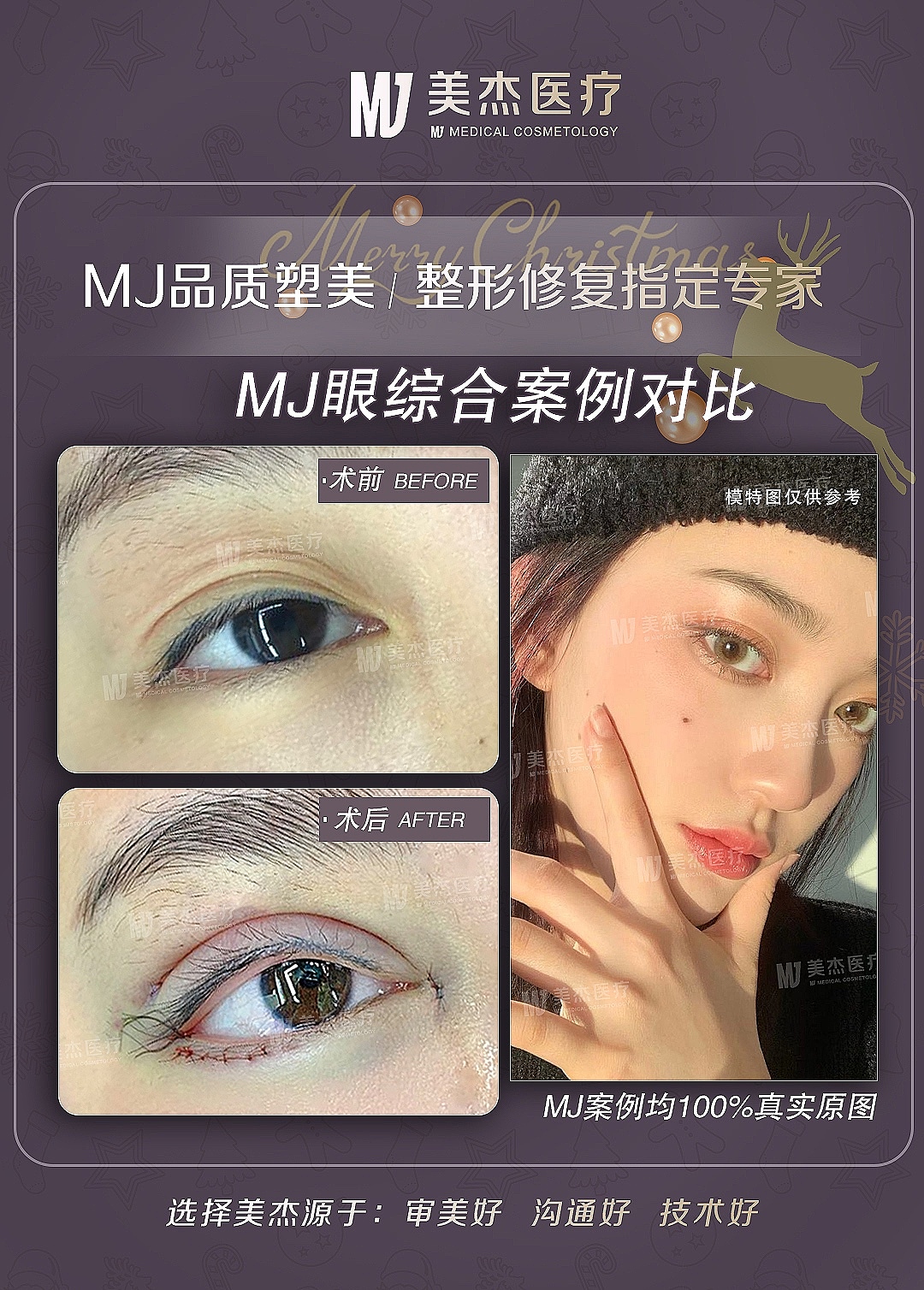 医美（图ZMTkwNDc5NTQ4） - 海报 - 站酷设计师Riose原创素材 - 站酷ZCOOL