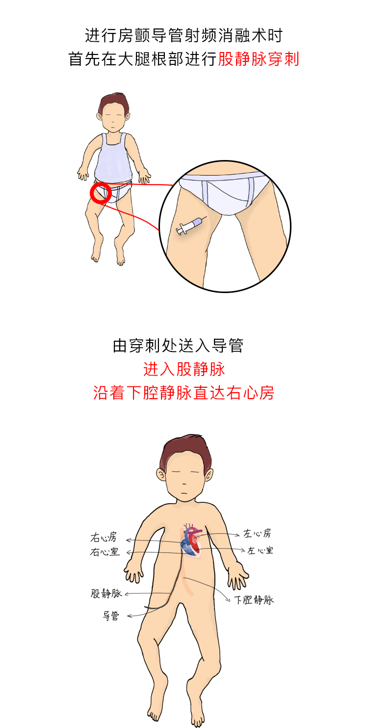 房颤漫画（图ZMTE5NzUxOTky） - 商业插画 - 站酷设计师G_Fsky原创素材 - 站酷ZCOOL