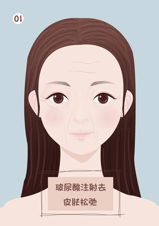 玻尿酸，玻尿酸填充，玻尿酸丰脸部（图ZMTk5NzA4MzY4） - 艺术插画 - 站酷设计师没事画画哦原创素材 - 站酷ZCOOL