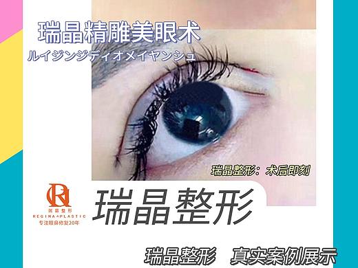 医美早安案例（个人主页-ZNDY5MzkwNTY=） - 电商 - 站酷设计师zqy1251100原创素材 - 站酷ZCOOL