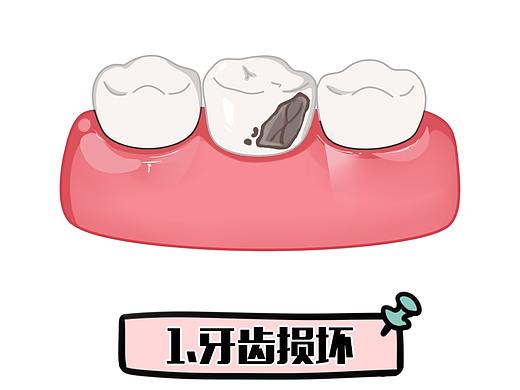 镶牙流程