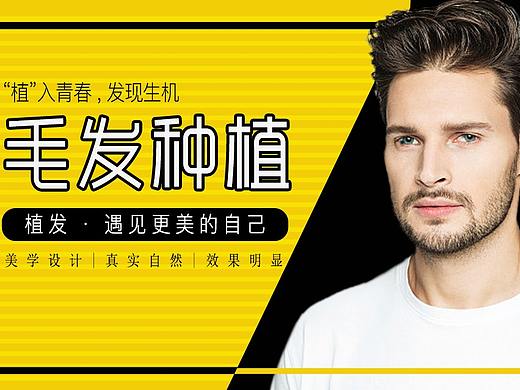 头发种植